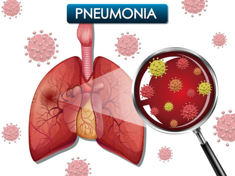 Mengenal Mycoplasma Pneumonia: Penyebab, Gejala dan Cara Mencegah