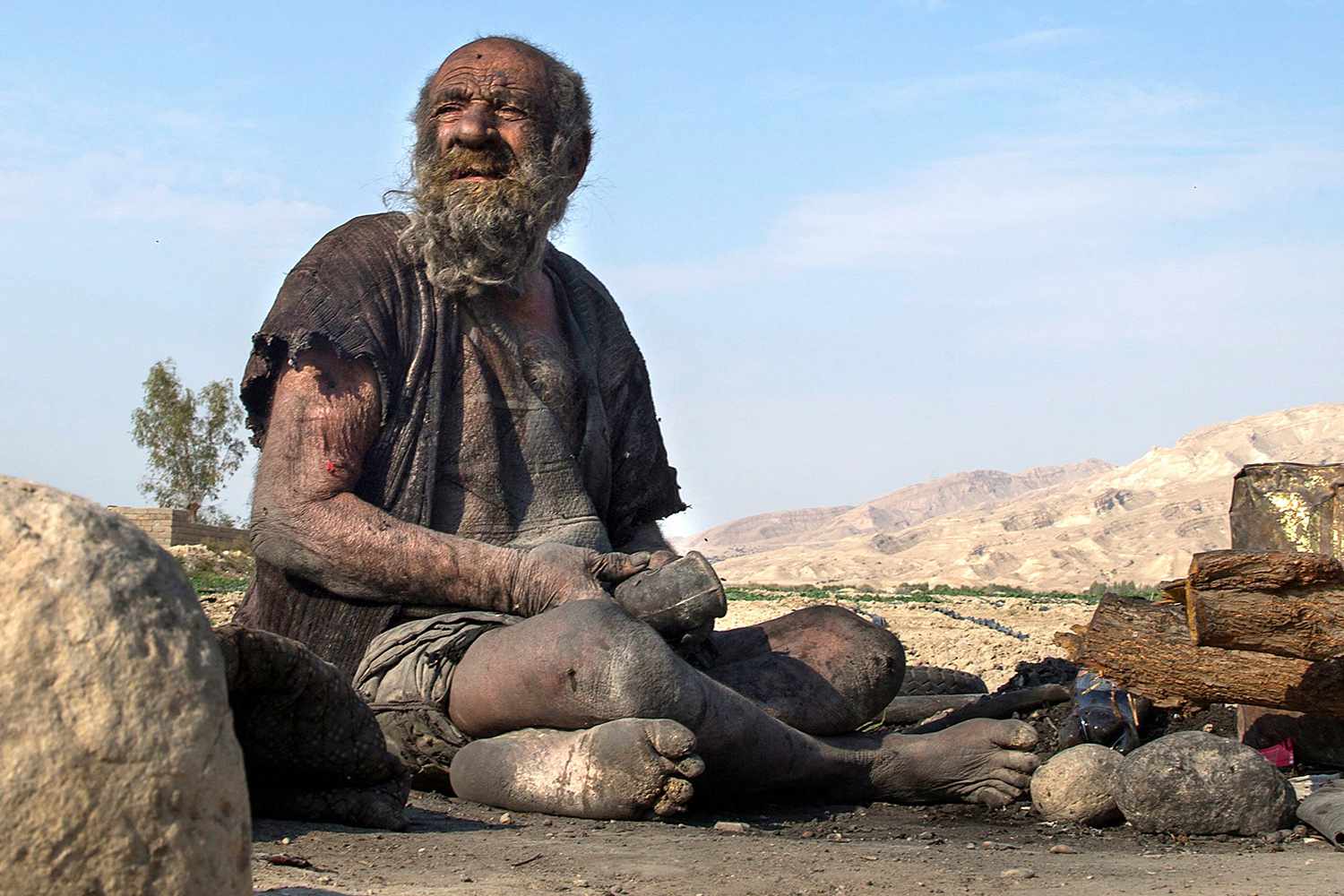 Самого грязного человека. Аму Хаджи, который не мылся 60 лет. Аму Хаджи человек который не мылся. Мужчина который никогда не мылся.