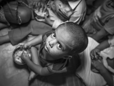 Perbedaan Stunting dan Gizi Buruk