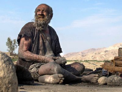 Kisah Hidup Manusia Terkotor di Dunia