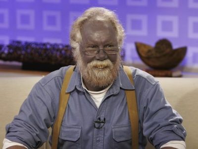 Kisah Seorang Pria yang Kulitnya Berubah Jadi Biru